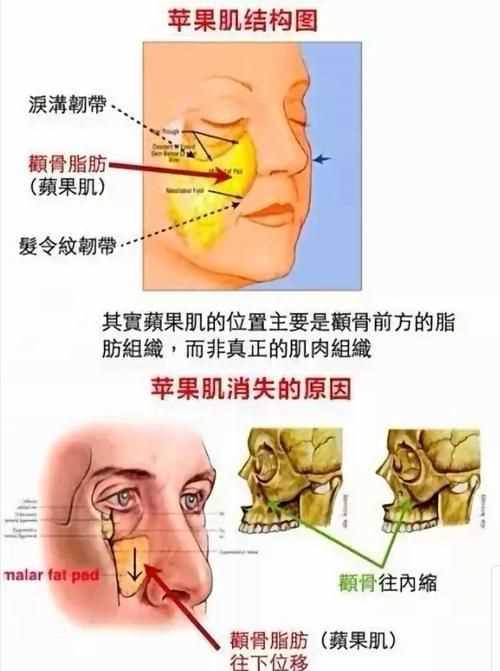 顴骨是指五官的哪個地方圖片
