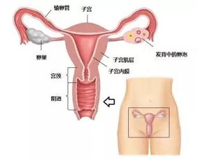 可以讓人流產(chǎn)的方法有哪些問題