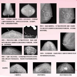 深部觸診法包括哪些簡述其觸診方法及臨床意義