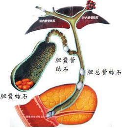 對(duì)膽的檢查有哪些方法