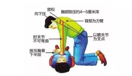 按壓,簡述,注意事項(xiàng)