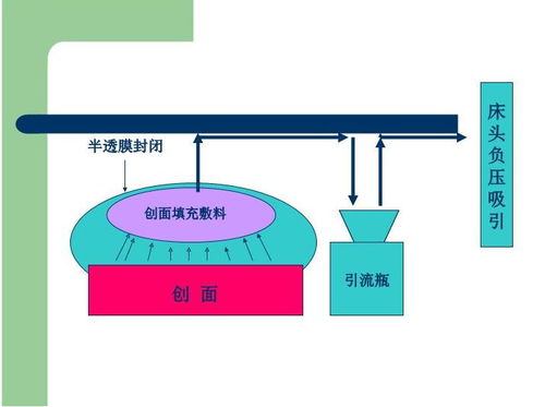 vsd負(fù)壓吸引的注意事項(xiàng)