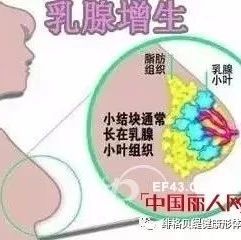 小葉增生的注意事項,雙乳小葉增生怎么辦,要注意些什么,小葉增生術后注意事項