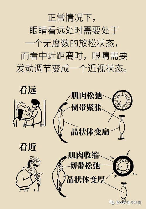 散瞳驗(yàn)光的危害及注意事項(xiàng),散瞳驗(yàn)光的意義及注意事項(xiàng),散瞳驗(yàn)光的目的及注意事項(xiàng)