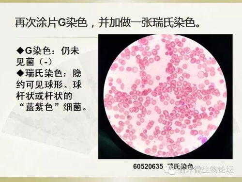 鏈球菌,鑒定,注意事項(xiàng),試驗(yàn)