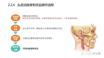 血氣,標本,時應(yīng),注意事項