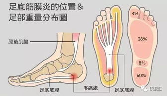 腰背肌筋膜炎注意事項(xiàng)
