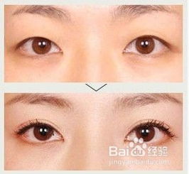割雙眼皮需要注意哪些問(wèn)題,雙眼皮術(shù)前術(shù)后注意事項,做雙眼皮前后注意事項有哪些
