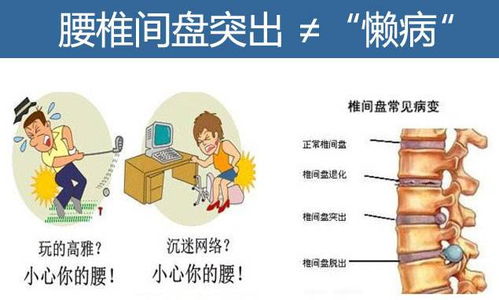 腰椎盤凸出手術,腰椎盤凸出治療,腰椎盤微創(chuàng)手術后注意事項