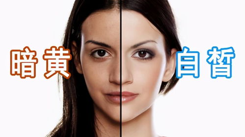臉過完敏是不是以后都要注意事項(xiàng)