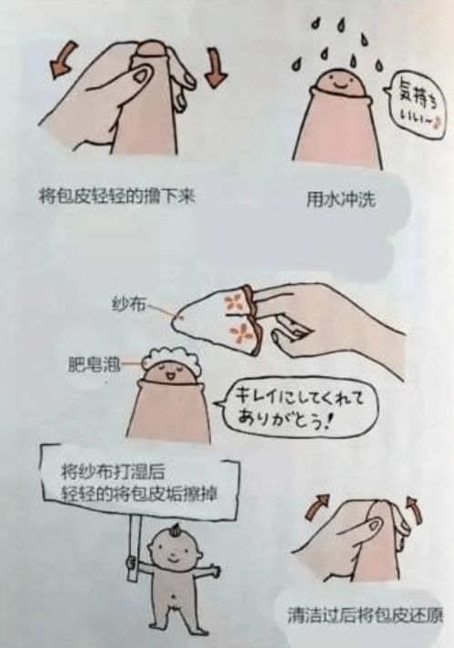 男生割包皮后注意事項(xiàng)