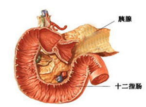 胰腺癌術后飲食注意事項,胰腺腫瘤飲食注意事項,胰腺手術后注意事項
