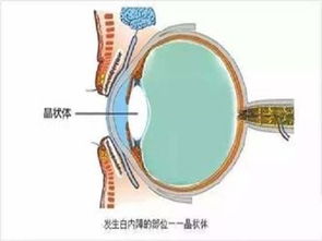 脖子做完手術(shù)后怎么注意事項(xiàng)