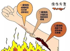 燒傷浸浴療法的注意事項(xiàng),心理暴露療法注意事項(xiàng),燒傷暴露療法是什么意思