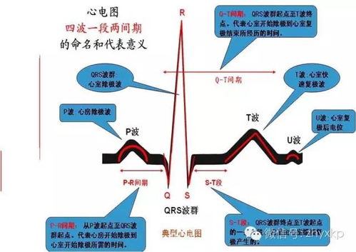 心電圖,測(cè)量,注意事項(xiàng)