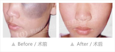 上海,注意事項(xiàng),激光,第九人