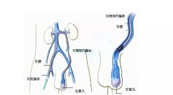 手術(shù)后,注意事項