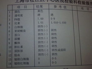 尿常規(guī)檢查取尿注意事項,尿常規(guī)檢查的注意事項,做尿常規(guī)檢查注意事項