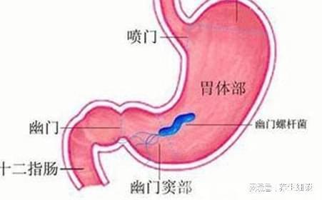 反流性胃炎注意事項(xiàng),糜爛性胃炎注意事項(xiàng),反流性胃炎飲食注意事項(xiàng)