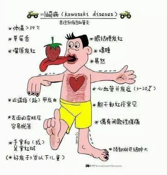 川崎病后期要注意事項(xiàng)