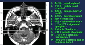 增強核磁共振注意事項
