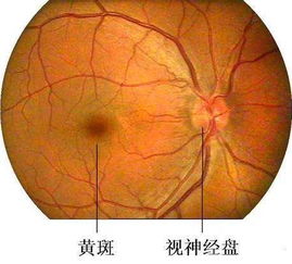 黃斑水腫飲食注意事項(xiàng),黃斑出血飲食注意事項(xiàng),眼病白內(nèi)障術(shù)后飲食有什么注意事項(xiàng)