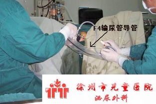 膀胱沖洗的操作流程及注意事項,膀胱沖洗的目的及注意事項,持續膀胱沖洗的護理及注意事項