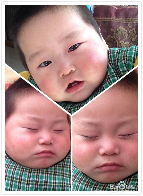 風疹,注意事項,幼兒