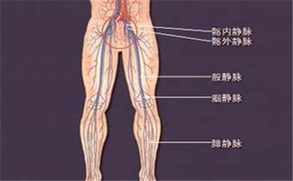 靜脈血栓形成注意事項(xiàng)