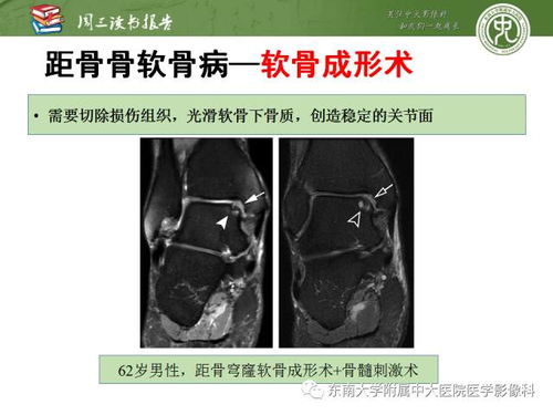 做ct后飲食注意事項(xiàng)
