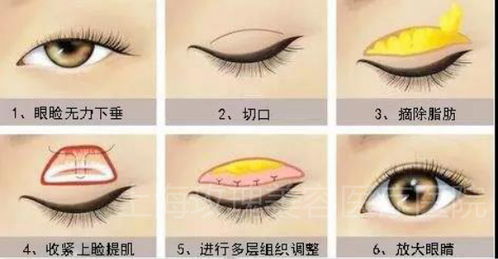 術(shù)后,眼部,注意事項,抽脂