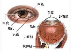 遺傳性白內(nèi)障注意事項(xiàng)