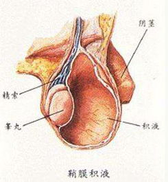 睪丸鞘膜翻轉(zhuǎn)術(shù)注意事項(xiàng),睪丸鞘膜翻轉(zhuǎn)術(shù)術(shù)中注意事項(xiàng),鞘膜積液翻轉(zhuǎn)術(shù)后注意事項(xiàng)