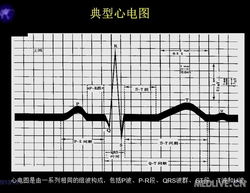 心電圖基礎(chǔ)知識講解,心電圖教學(xué)基礎(chǔ)知識,心電圖入門基礎(chǔ)知識