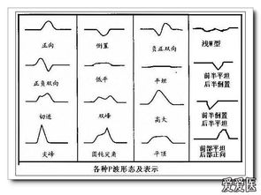 心電圖基礎(chǔ)知識(shí)本科生講座