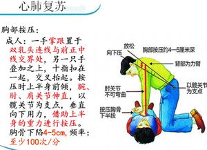 院前急救基礎(chǔ)知識