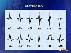 心電圖,基礎(chǔ)知識(shí),護(hù)理,教學(xué)