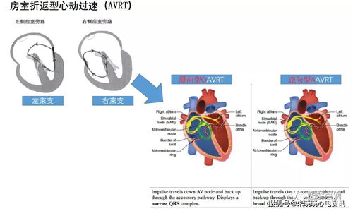 心電圖基礎(chǔ)知識(shí)網(wǎng)頁(yè)