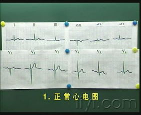 心電圖基礎(chǔ)知識教學(xué)