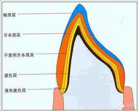 牙體預(yù)備的基礎(chǔ)知識(shí)
